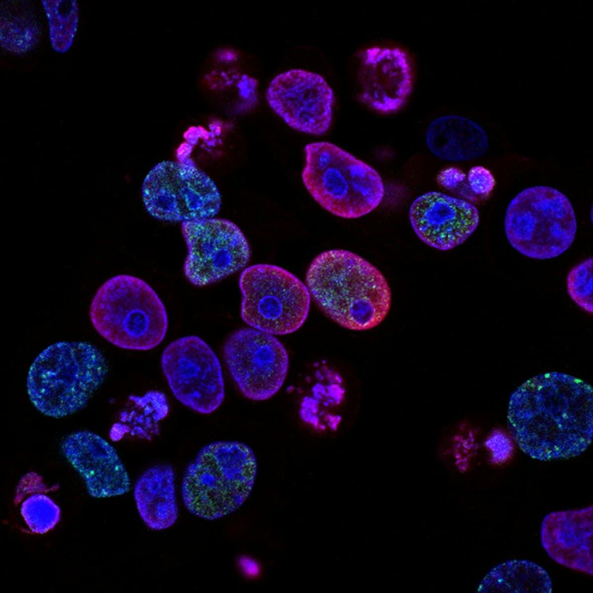 Immunology medical writing expertise
